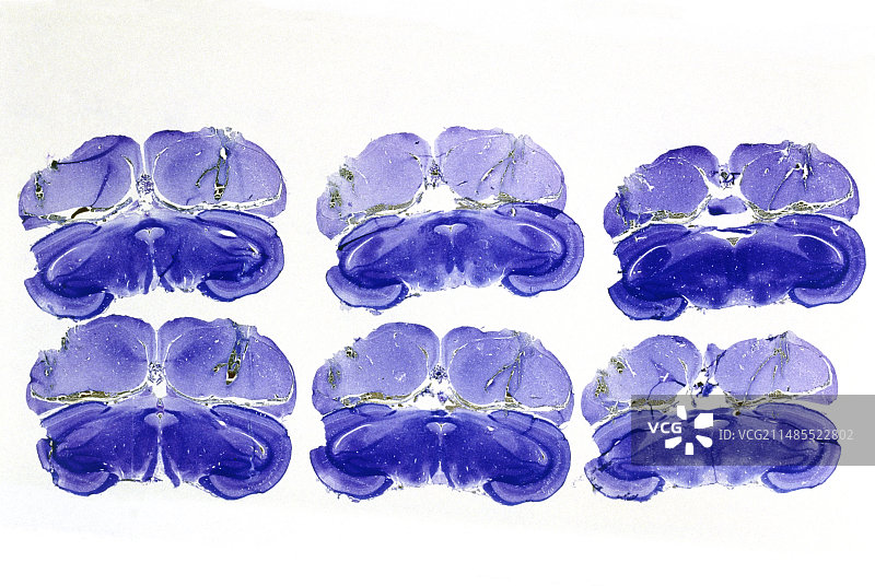 鹌鹑大脑图片素材