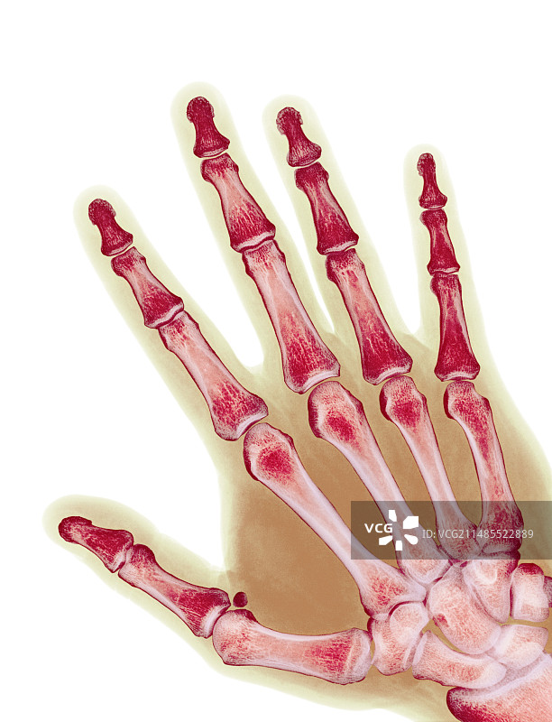 健康的成年人手部X光片图片素材