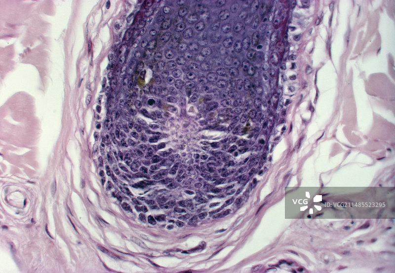 头皮毛囊图片素材