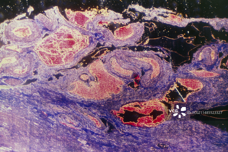 人卵巢的截面图片素材