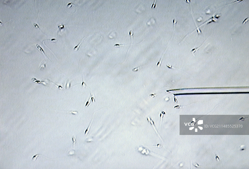 试管婴儿治疗图片素材