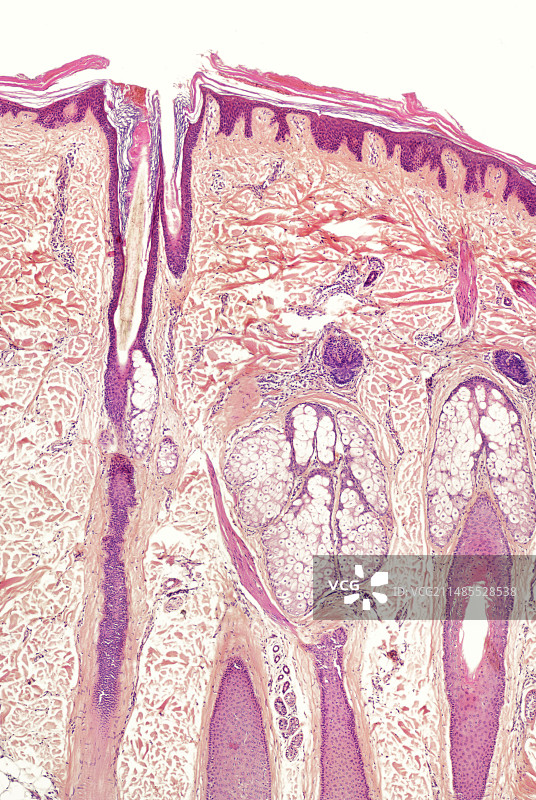 人体皮肤切片，光学显微照片图片素材