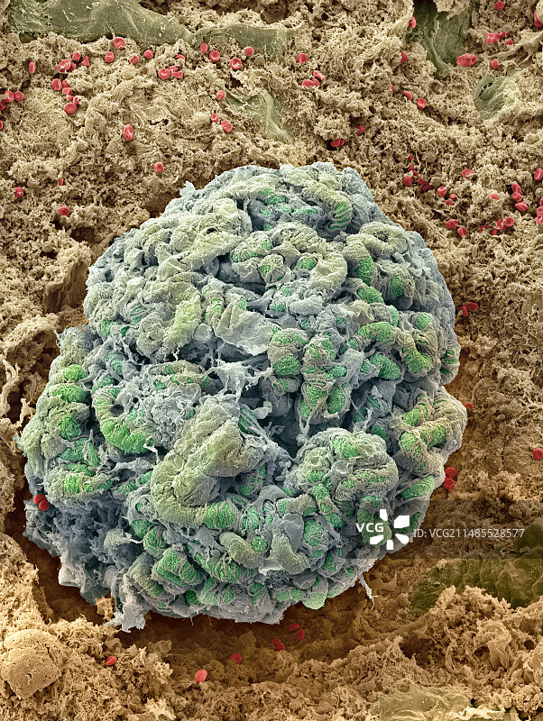 肾小球扫描电镜图图片素材