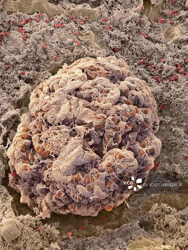 肾小球扫描电镜图图片素材