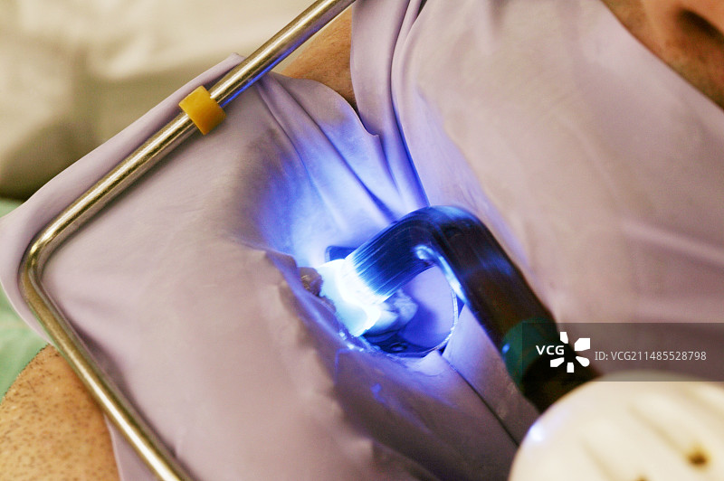 牙科治疗图片素材