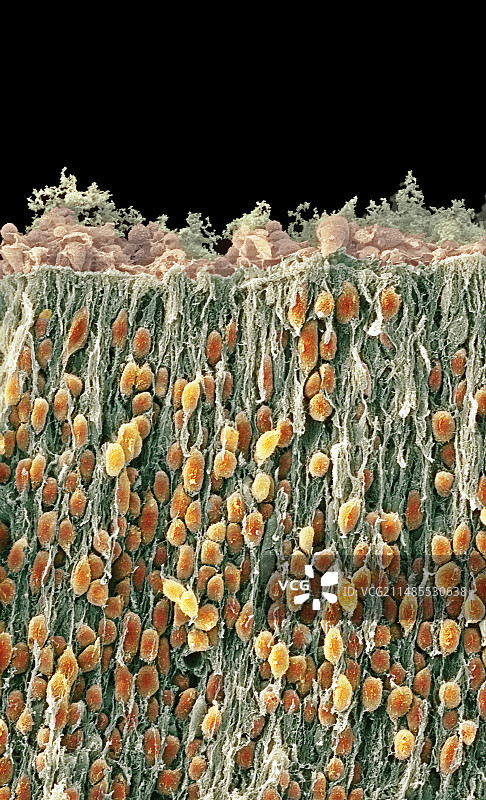 胎儿脑细胞扫描电镜图图片素材