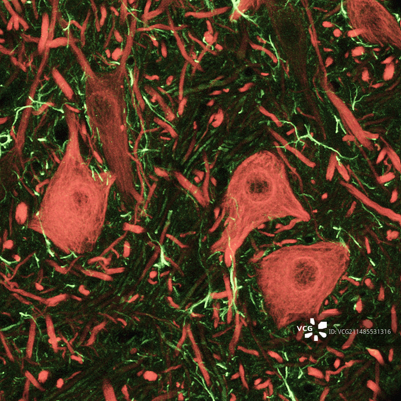 神经元共聚焦显微照片图片素材