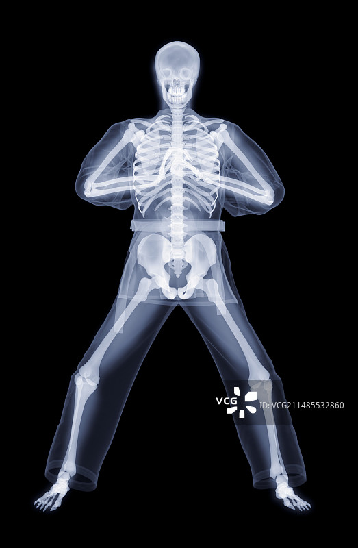 功夫问候，X光艺术作品图片素材