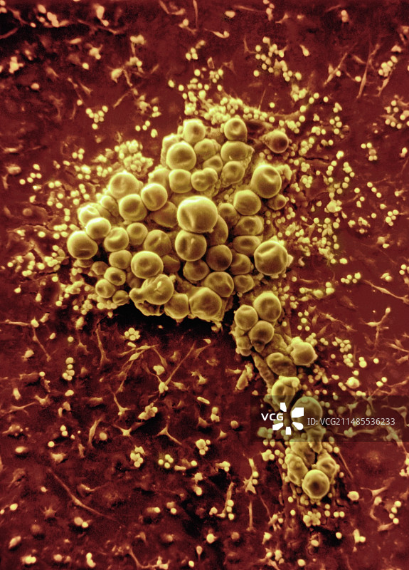 脂肪细胞，扫描电镜图片素材