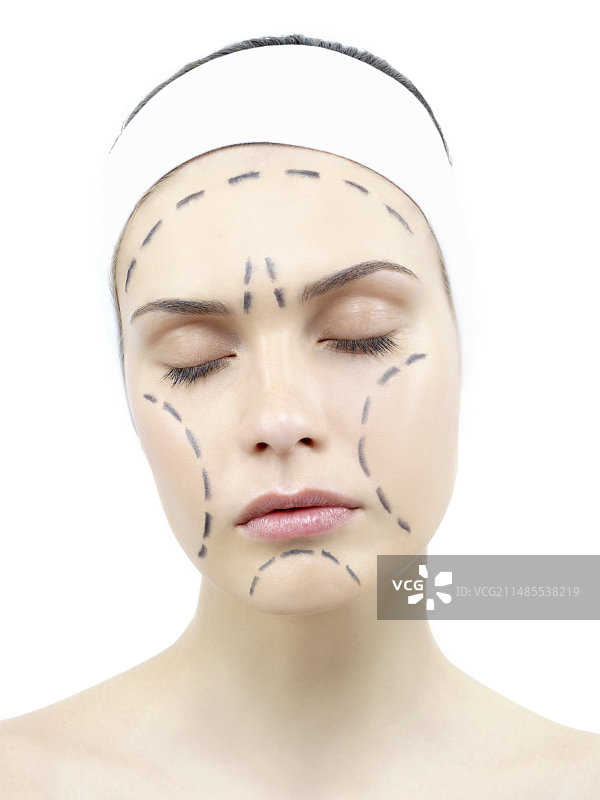 面部拉皮手术标记图片素材