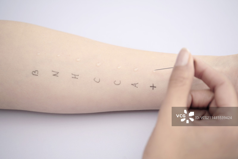 过敏测试图片素材