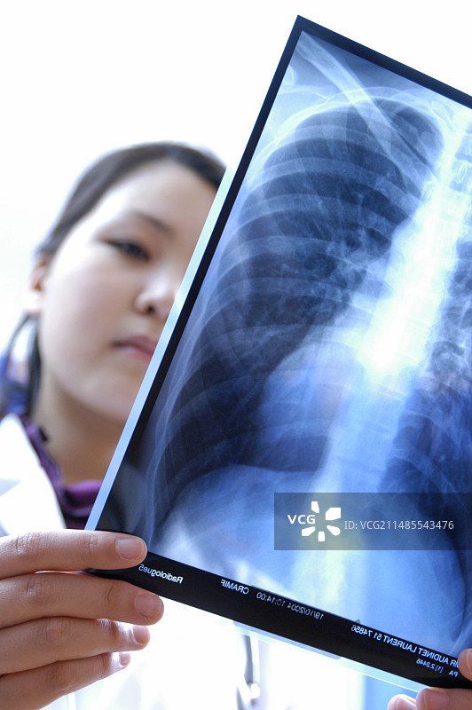 医生研究胸部X光片图片素材