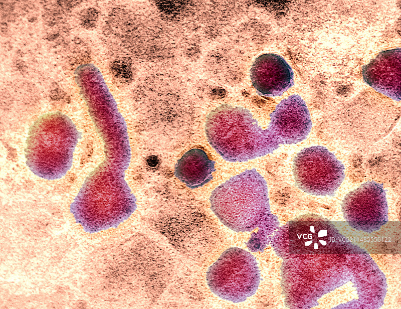 H5N1禽流感病毒颗粒（透射电镜）图片素材