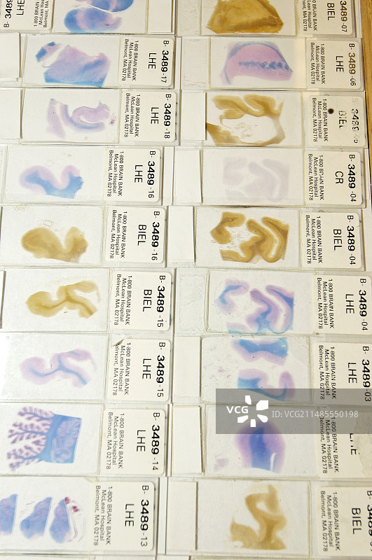 人脑显微镜切片图片素材