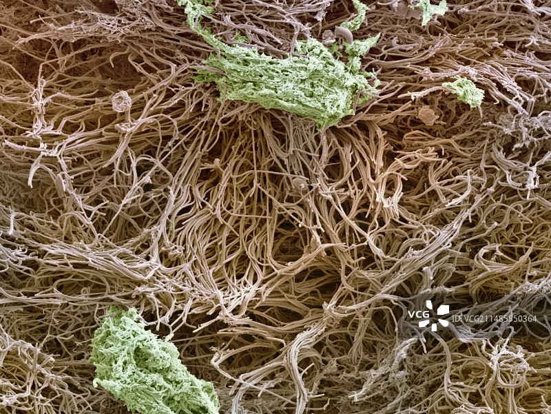 牙菌斑扫描电镜图图片素材