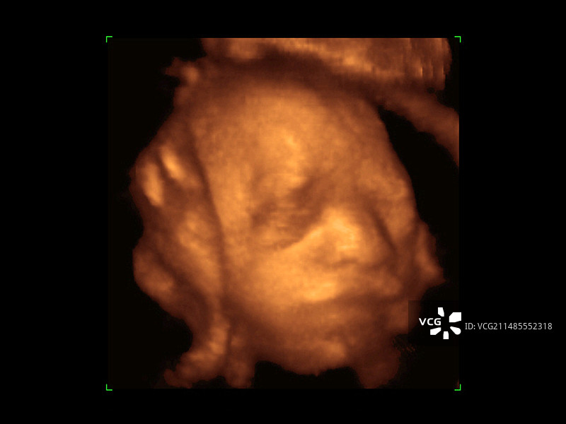 胎儿面部3D超声波扫描图片素材