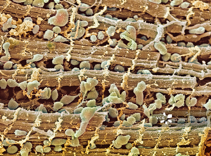 心肌扫描电镜图图片素材