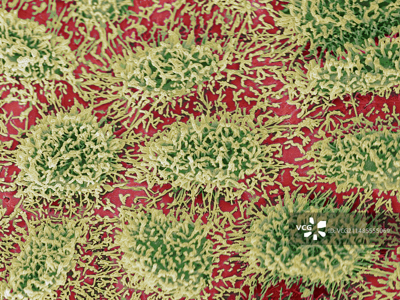 卵巢表面细胞扫描电镜照片图片素材