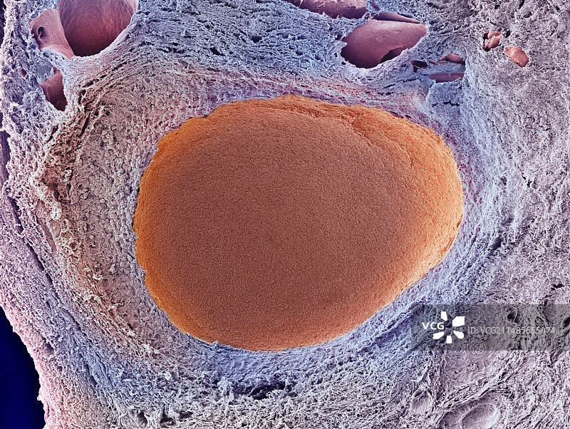 卵巢卵泡扫描电镜图片素材