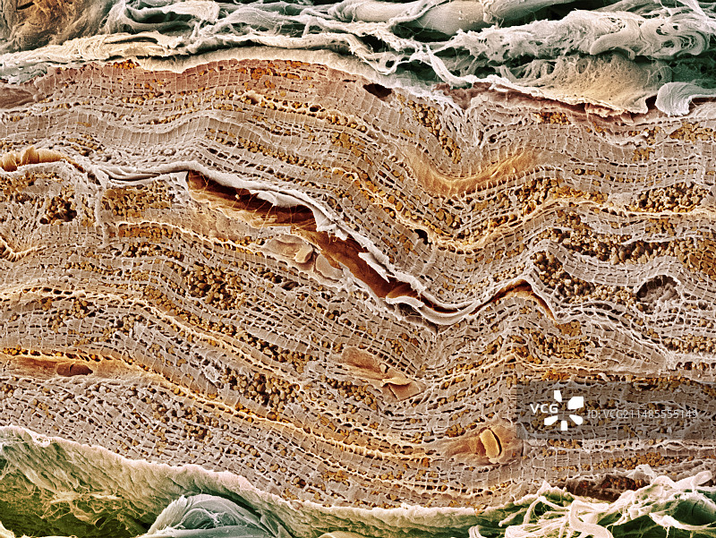 心肌扫描电镜图图片素材