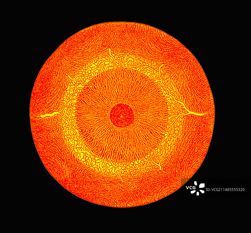 眼睛解剖结构图片素材