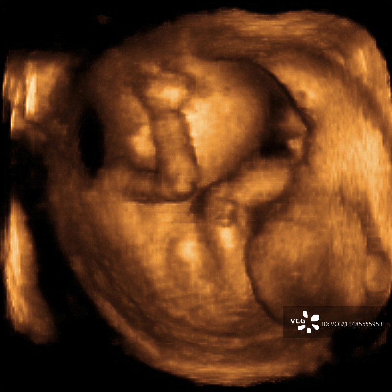 18周胎儿3D超声波扫描图片素材