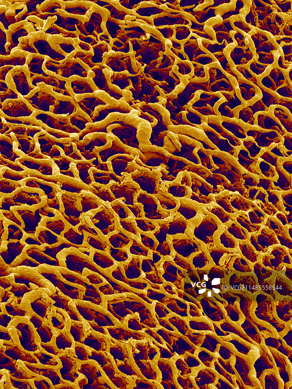 胃壁内的血管，扫描电镜图片素材