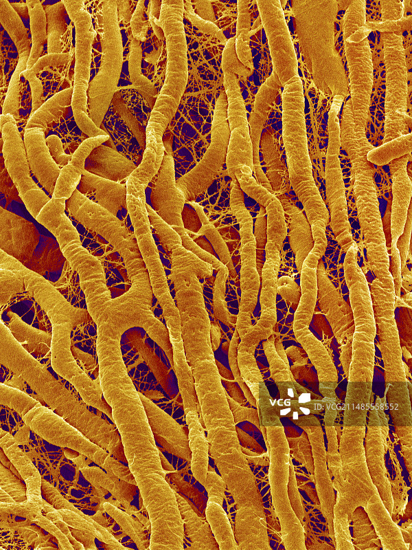 心肌血管，扫描电镜图图片素材