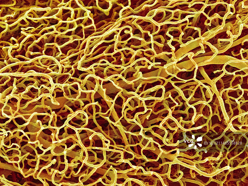 胰腺血管扫描电镜图图片素材