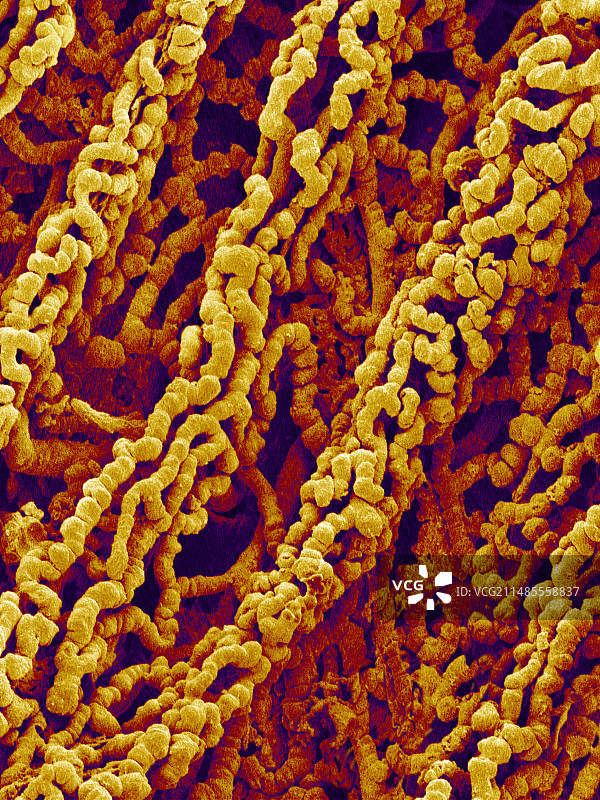 牙龈血管，扫描电镜图片素材