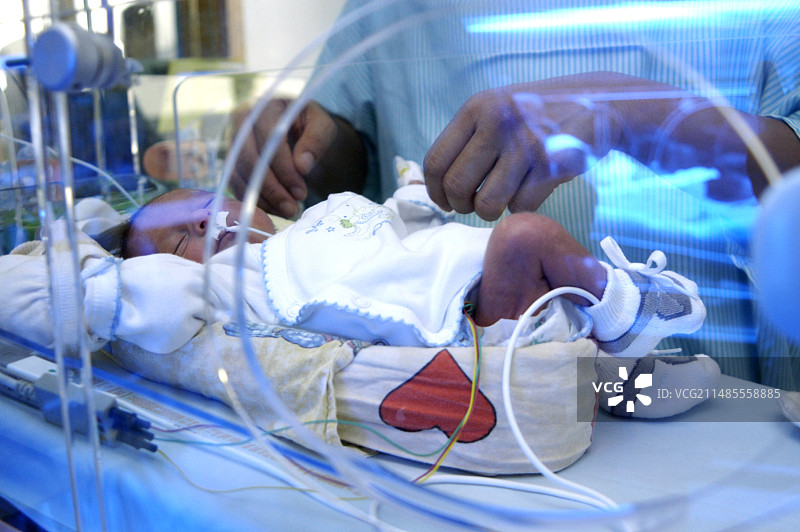 早产儿图片素材