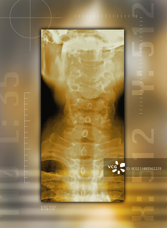 健康的颈椎骨X光片图片素材