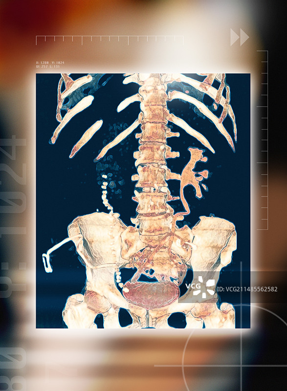 腹部骨骼3D CT扫描图片素材