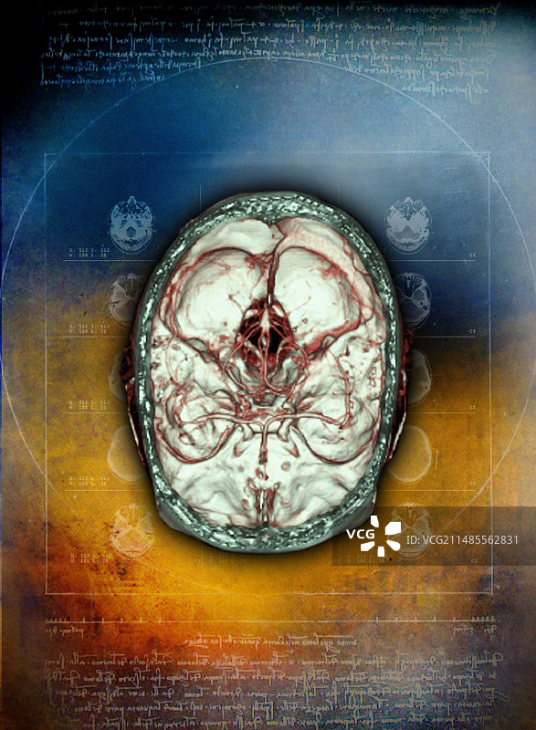 大脑和血管3D CT扫描图片素材