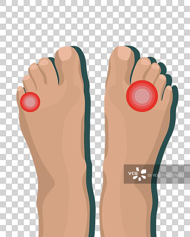 足部卫生图片素材