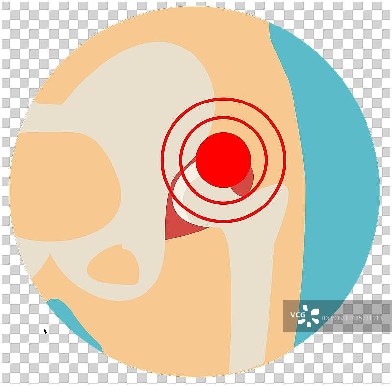 髋关节骨关节炎图标扁平风格正面图图片素材