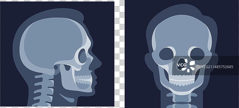 人头X光图像图片素材