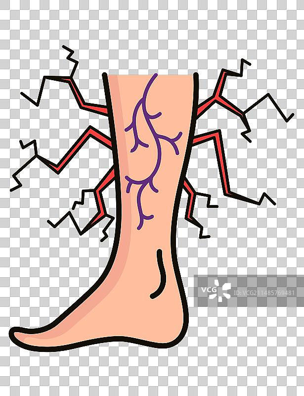 静脉曲张治疗图标违反循环图片素材