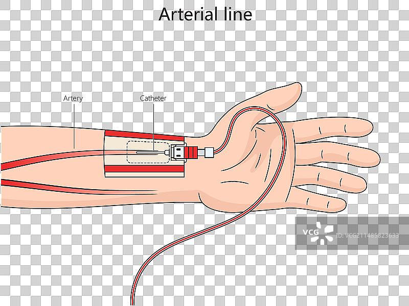 动脉线路结构医学图图片素材