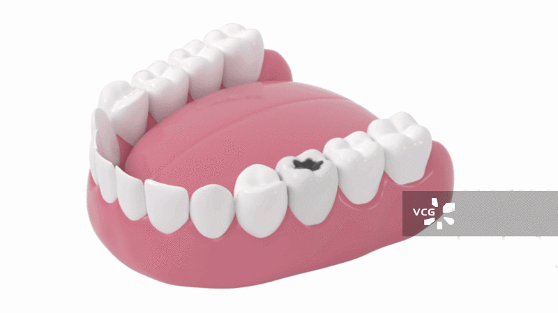 拔出蛀牙动画3D渲染图片素材