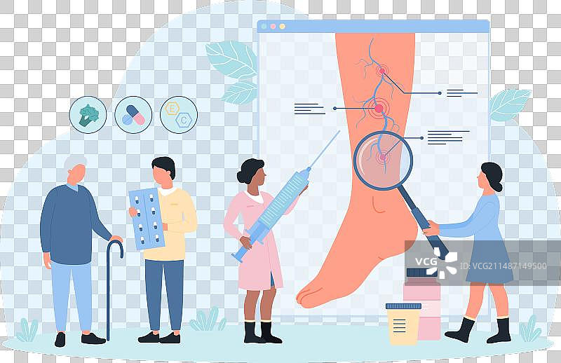静脉曲张血栓诊断治疗图片素材