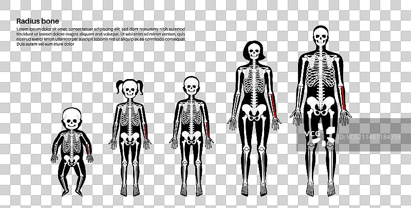 桡骨解剖图片素材