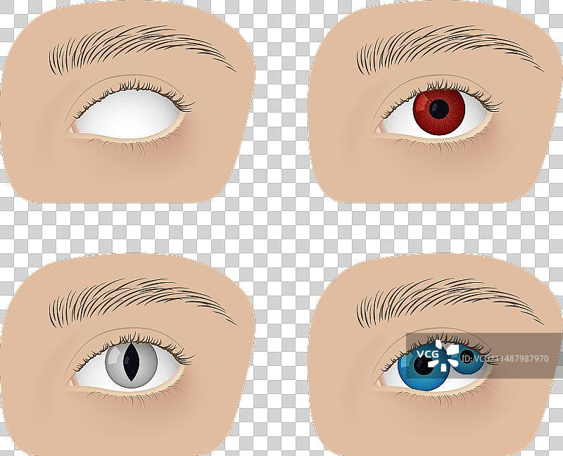 逼真的人类健康眼睛与白内障图片素材