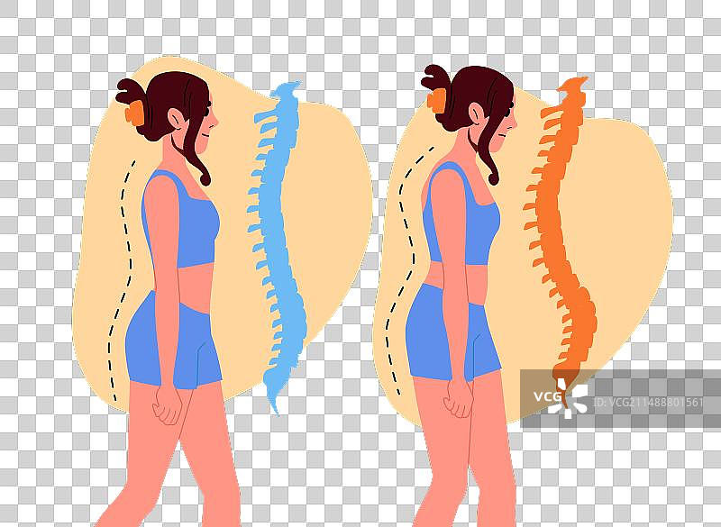女孩脊柱侧弯概念图片素材