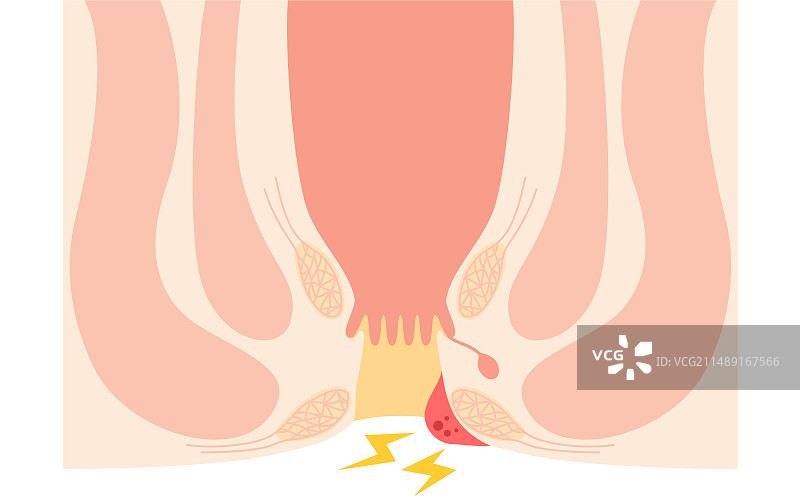 截面图图片素材