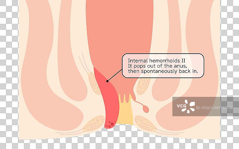 截面图图片素材