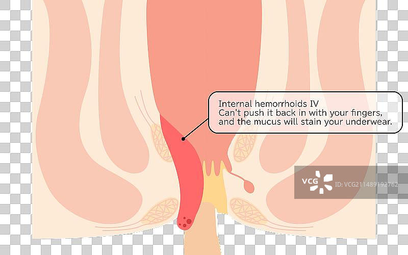 截面图图片素材