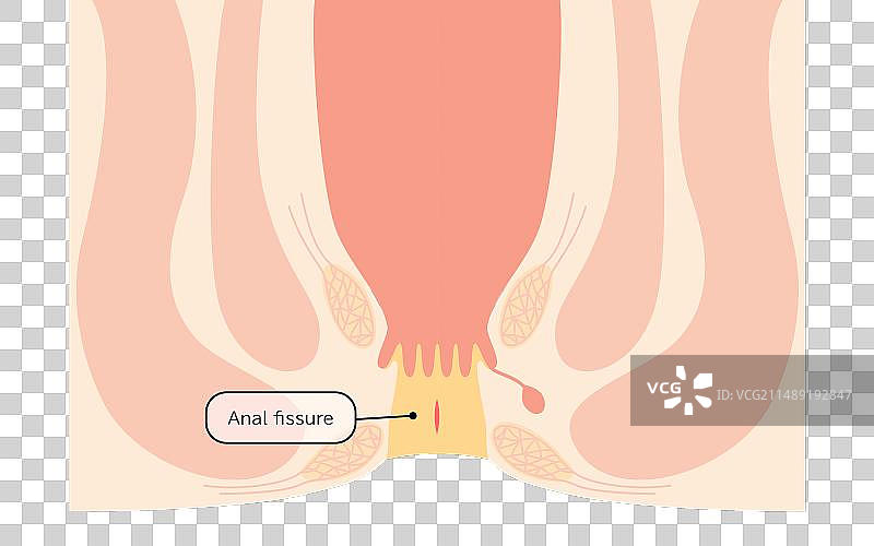 截面图图片素材