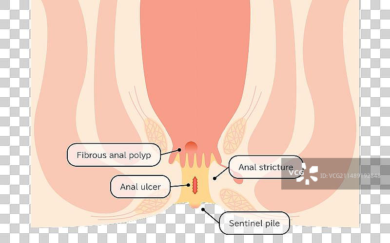 截面图图片素材