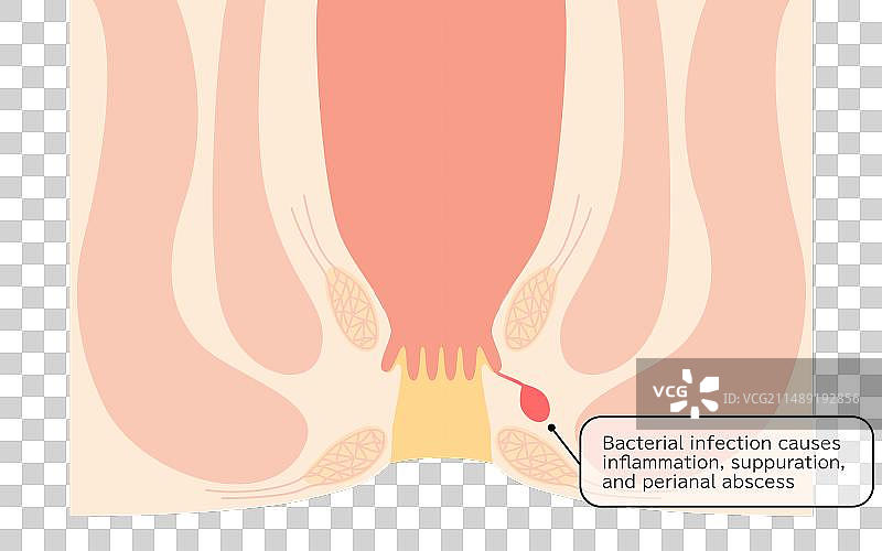 截面图图片素材